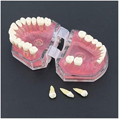 Wzqwzj Модел на човешки орган LMEILI Стоматологичен Стандартен модел с Подвижни зъби Стоматологично Изследване на Обучение Модел на Зъбите Медицинска Модел орган