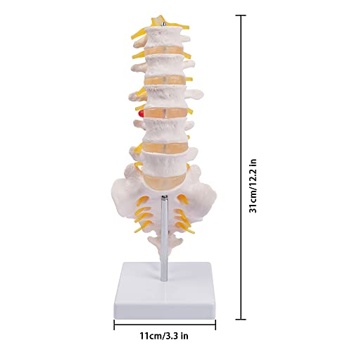 Модел на Лумбалния отдел на гръбначния стълб breesky - Анатомическая модел на Лумбалните прешлени на Човек в естествен размер с Крестцом и Спинномозговыми нерви, Медицински Chiropractor, Обучение Демонстрация На студенти