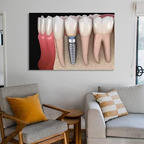Снимки на стените на стоматологична болница, Украса зъболекарски кабинет, Защита на зъби, Ортодонтия, Стоматологични знания Платно Стенни Артистични Щампи за decor Декор на Стая Декор спални Подаръци 24x36 инча (60x90